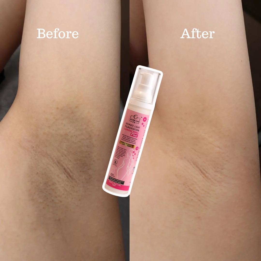 Intimate Light pigmentation correcting fluid.